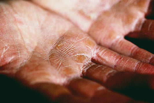 UNIQUELYFORU.COMO UniquelyForU persons palm in close up photography Photo by Alexander Grey on Unsplash